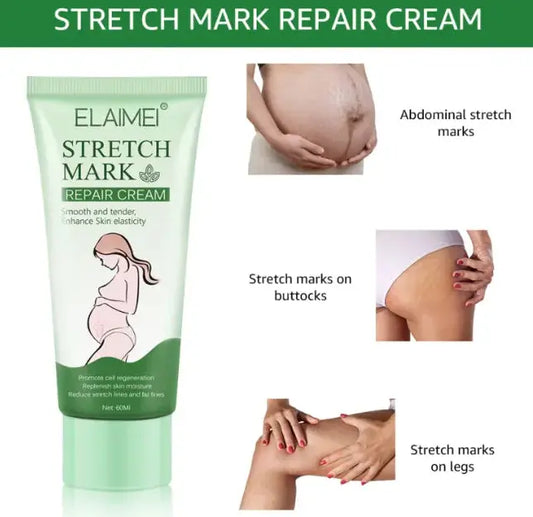 Crema reparadora de estrías Skinluminova
