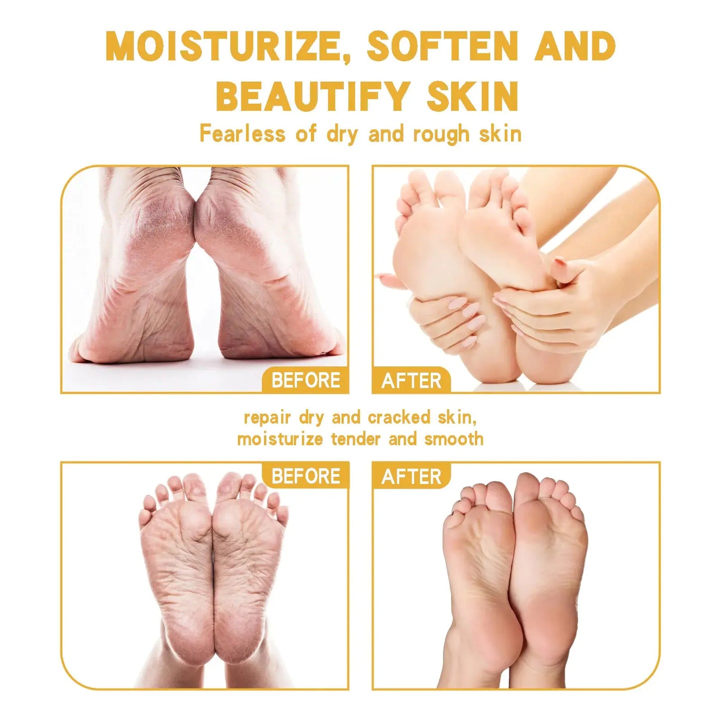 Crema Shurun para pieles agrietadas, cuidado de los pies, hidratante y antiagrietamiento Skinluminova