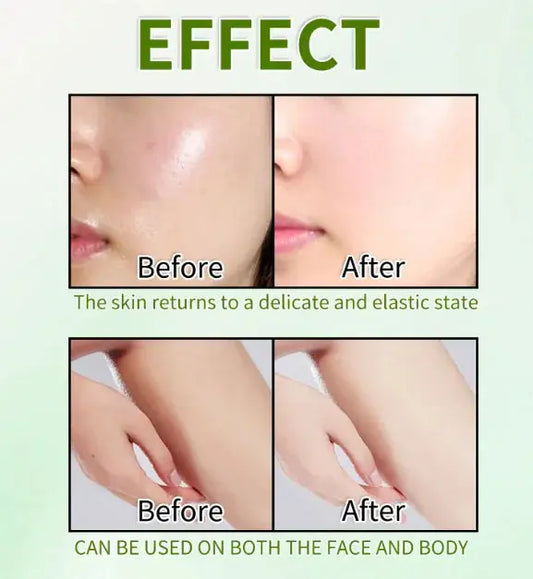 Gel exfoliante 60 g Skinluminova